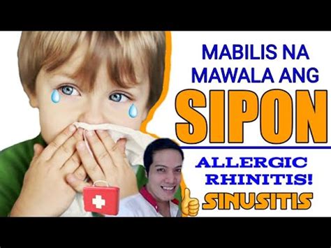 mabisang gamot sa allergic rhinitis